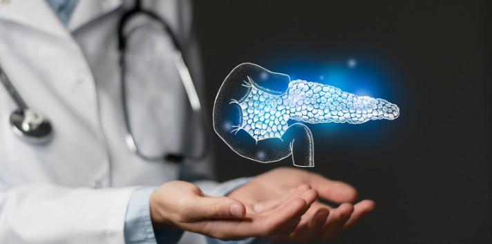 すい臓がんは遺伝するのでしょうか?