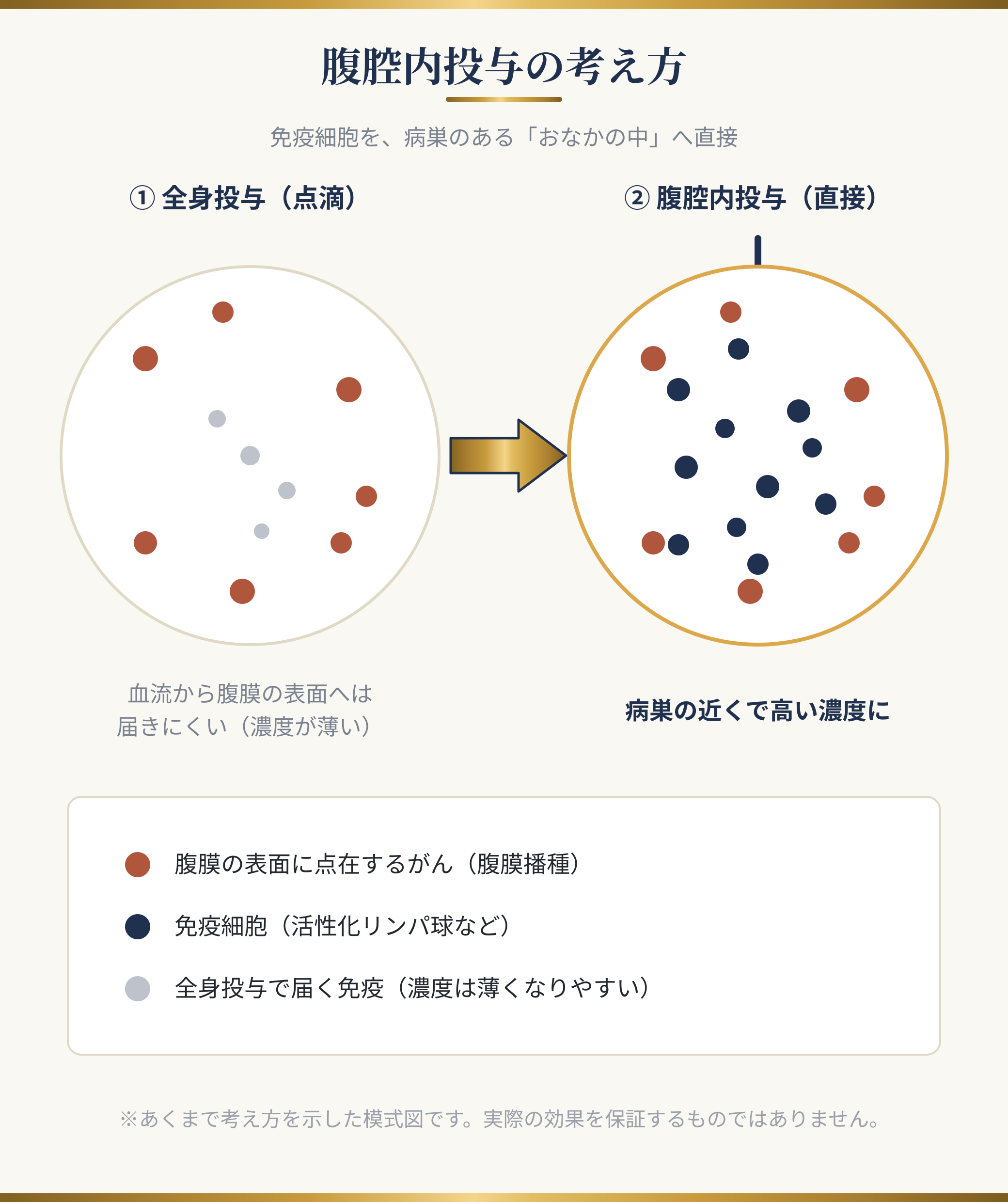 腹腔内投与の考え方:免疫細胞を腹腔内に直接届け、病巣の近くで高い濃度で働かせる模式図。全身投与(点滴)では腹膜表面の病巣に免疫が届きにくいのに対し、腹腔内投与では病巣の近くに免疫細胞が高密度に集まる。