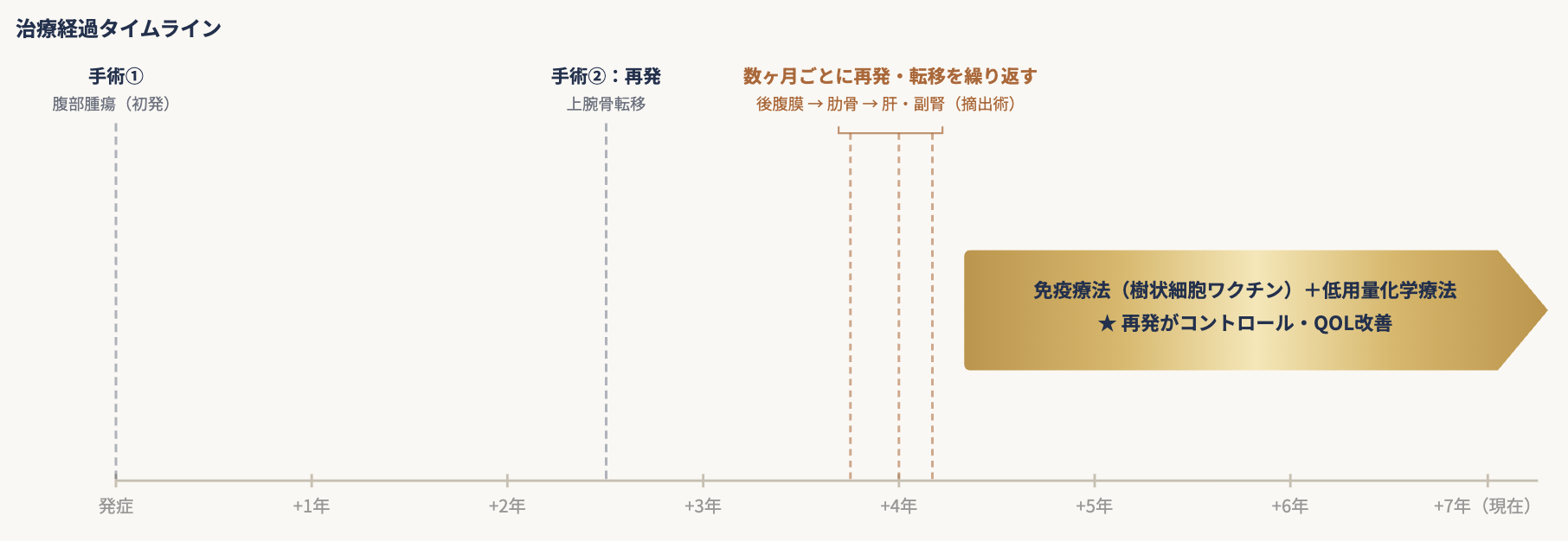 平滑筋肉腫3018 治療経過タイムライン（数ヶ月ごとの再発が免疫療法＋低用量化学療法でコントロール）